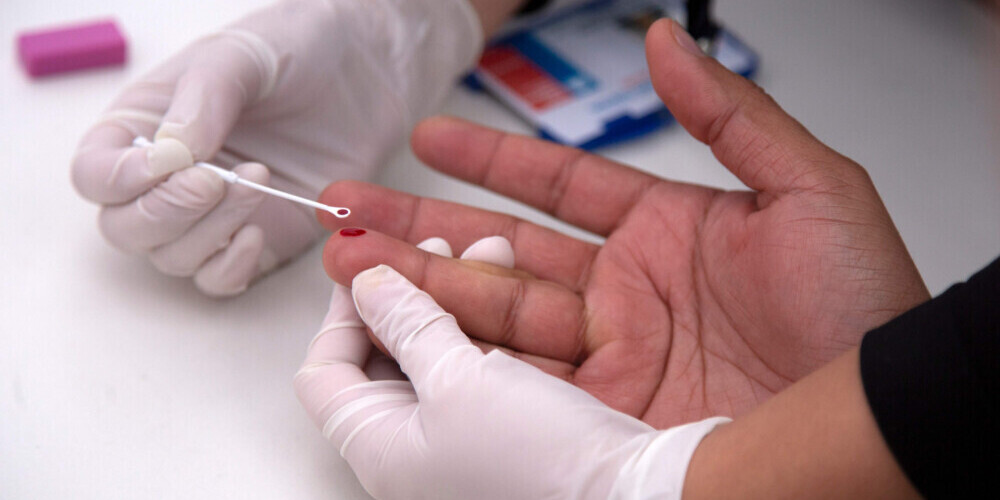 Cilvēka imūndeficīta vīruss jeb HIV (angļu: Human immunodeficiency virus) ir retrovīrusu dzimtas lentivīruss, kas tiek nodots tālāk ar spermas, vagīnas gļotu vai asins palīdzību. Tas uzbrūk un pakāpeniski sagrauj cilvēka imūnsistēmu. HIV izraisa akūtu imūndeficīta sindromu (AIDS), kas pašlaik ir neārstējams. Saslimstība ar HIV pēdējos 25 gados ir ievērojami pieaugusi, un tiek lēsts, ka pasaulē šajā laikā no šī vīrusa ir miruši aptuveni 25 miljoni cilvēku.