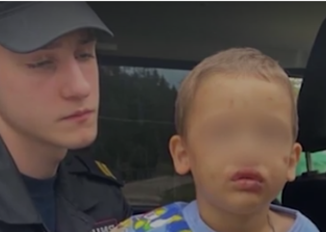 Избивал, тушил сигареты, сломал челюсть: 2-летний малыш сбежал от отчима-изверга