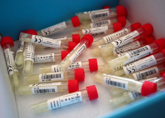 В Литве за сутки выявлено 17 новых случаев Covid-19, в Эстонии - 7