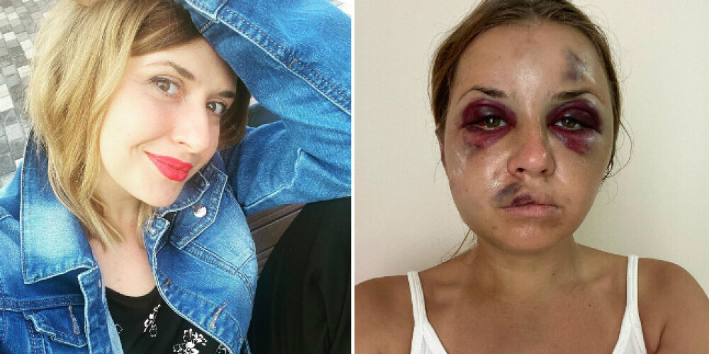 Шокирующие фото: в поезде мужчина избил и едва не изнасиловал телеведущую на глазах у ее сына