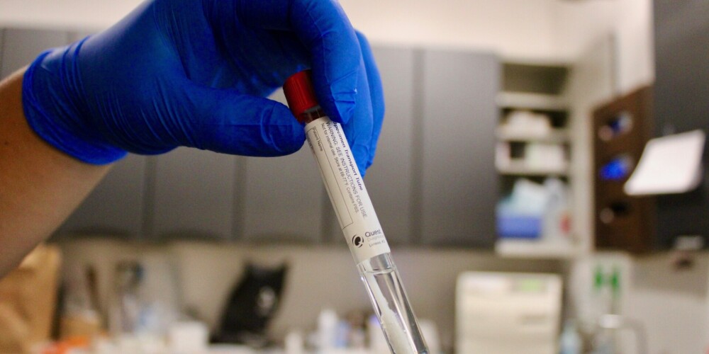 Igaunijā pieci jauni inficēšanās ar koronavīrusu gadījumi