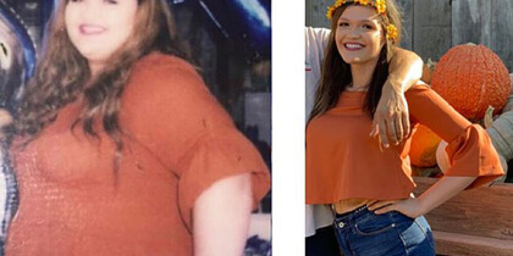 "Я была такая нездоровая и несчастная". Девушка похудела на 88 килограммов и изменилась до неузнаваемости
