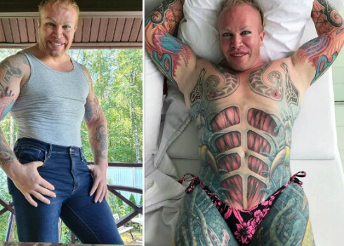 Шпак александр фото до и после пластики Шпак александр фото до и после пластики