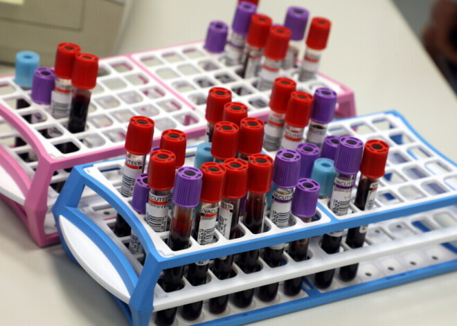 За прошедшие сутки в Латвии выявлено 4 новых случая Covid-19