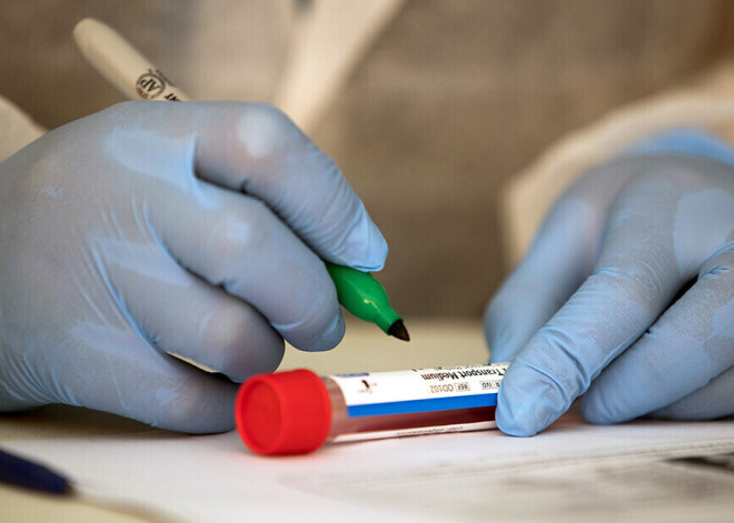 В Латвии скончался еще один пациент с Covid-19, выявлено 8 новых случаев заболевания