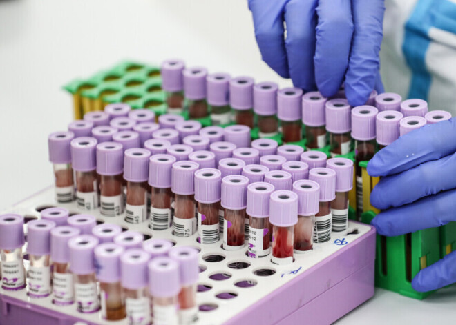 Новый рекорд Covid-19 в Латвии: выявлено 898 новых случаев, умерли еще 4 человека