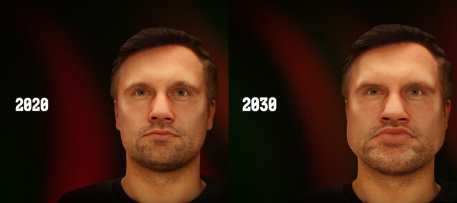 Aktieris Andris Bulis piekritis ilustratīvai demonstrācijai, kā izmainās seja akromegālijas slimniekiem.