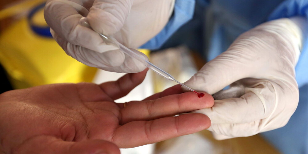 Zinātnieki: Covid-19 pacientu asins ainā redzamas izdzīvošanas iespējas