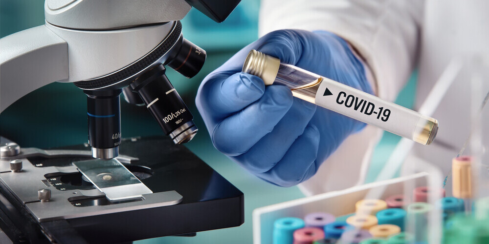 Новое осложнение Covid-19: антитела могут атаковать организм после выздоровления