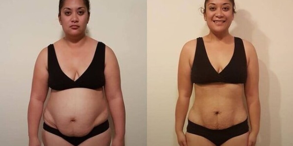 Выпивавшая 20 банок колы в день женщина рассказала о похудении на 58 килограммов