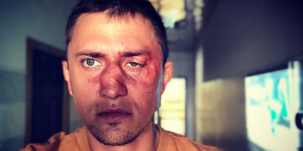 Бизнесмен, избивший Павла Прилучного: "Он был нетрезв и хотел меня ударить в голову"