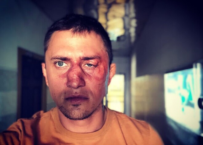 Бизнесмен, избивший Павла Прилучного: "Он был нетрезв и хотел меня ударить в голову"