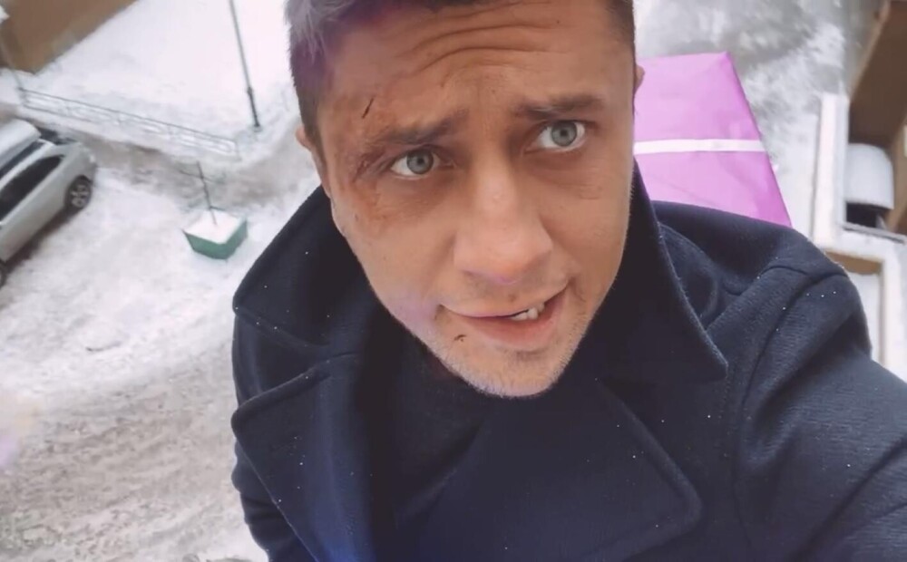 Фото прилучного до и после пластики Фото прилучного до и после пластики