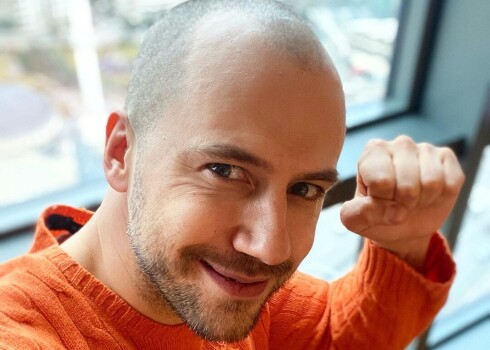 Актер Иван Жидков сделал пересадку волос за 5 000 евро