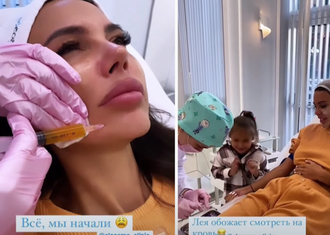 "Лея обожает смотреть на кровь": Самойлова сделала "уколы красоты" при дочери