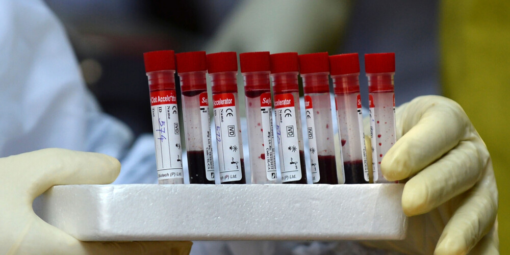 Kopš novembra piecreiz biežāk donoru asinīs atrod Covid-19 antivielas