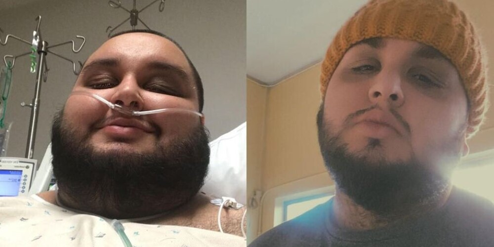 Мужчина сбросил треть веса за пару лет, чтобы впервые в жизни не чувствовать ненависти к своему телу