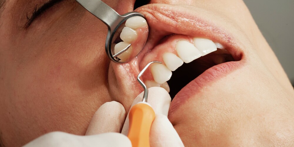 Zobārste par to, kā izvairīties no izplatītākajām mutes dobuma problēmām