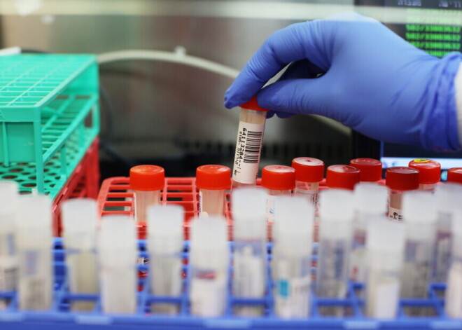 В Латвии выявлен угандийский штамм нового коронавируса