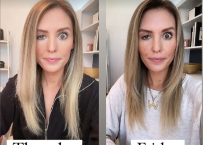 Блогер продемонстрировала неожиданные последствия укола ботокса
