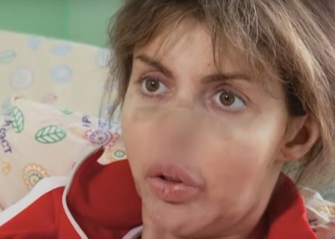 "Не могу ходить": состояние экс-жены Аршавина ухудшается