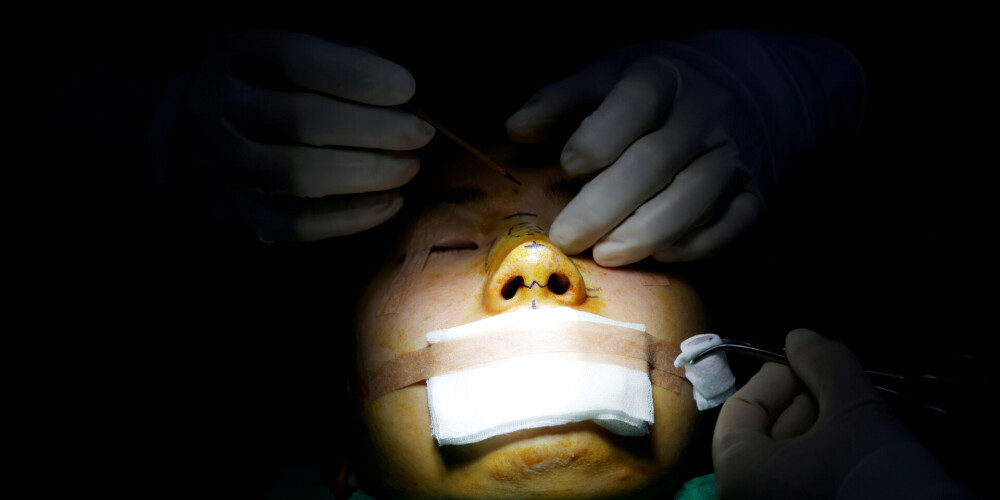 Bīstamie un rūpīgi slēptie "spoku ārsti" - viņu dēļ Dienvidkorejā uz plastisko operāciju galda mirst cilvēki