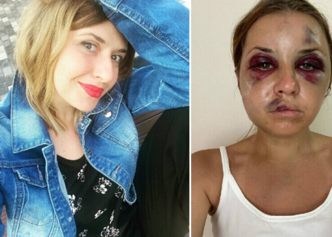 "Страх умер вместе с ним": скончался мужчина, который в поезде избил и пытался изнасиловать телеведущую