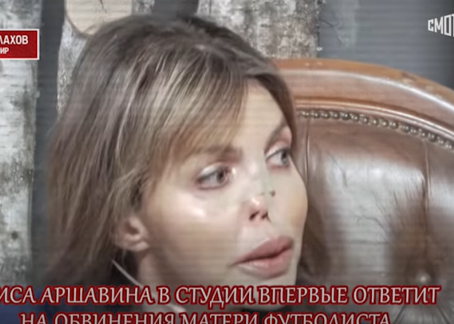 Экс-жена Аршавина с провалившимся носом впервые пришла в студию телешоу