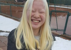 Iedvesmojošs stāsts: kā albīna ķīniešu meitene no bērnunama kļuva par žurnāla “Vogue” modeli