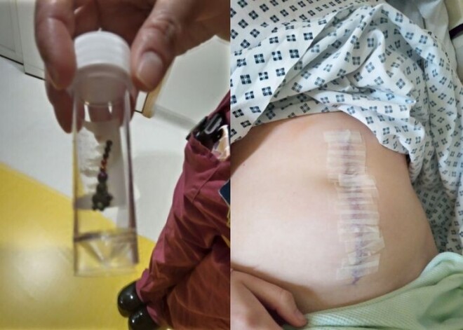 Опять магниты! Школьница попала в реанимацию после попытки повторить трюк из TikTok