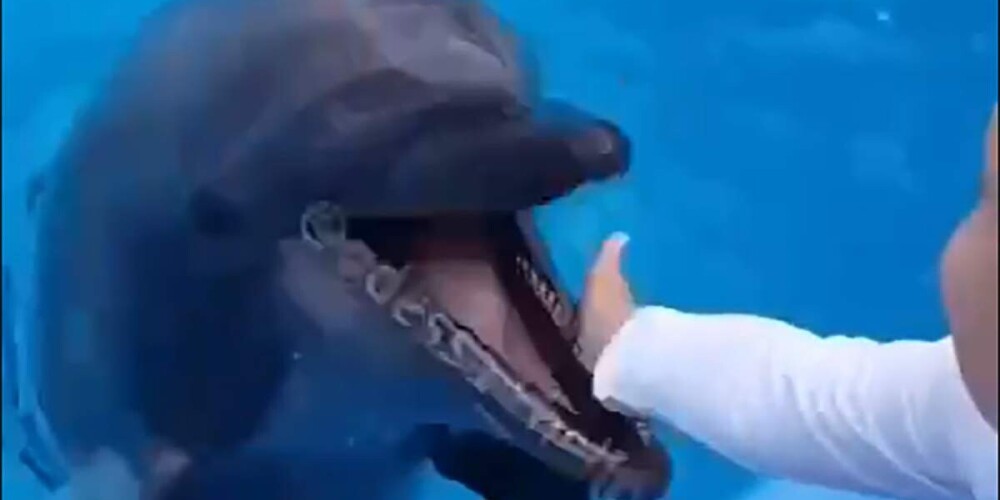 Дельфин укусил ребенка: мальчику пришлось зашивать рану