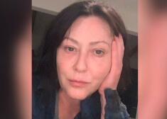 "Мое лицо отражает мою жизнь": онкобольная Шеннен Доэрти раскритиковала Голливуд за обилие пластических операций
