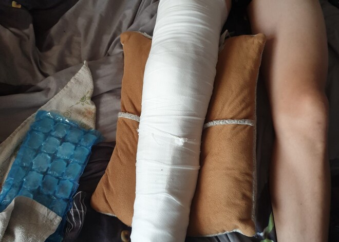 Рану зашивали в три слоя: мальчик посетил латвийский пляж и получил тяжелое ранение