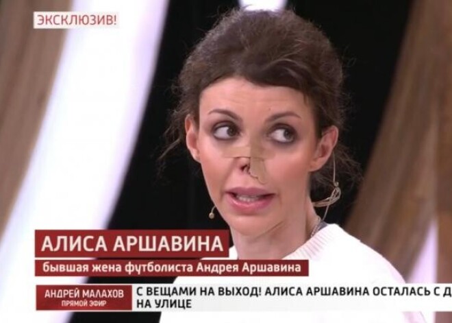 Экс-жена Аршавина: "Мне становится все хуже и хуже"