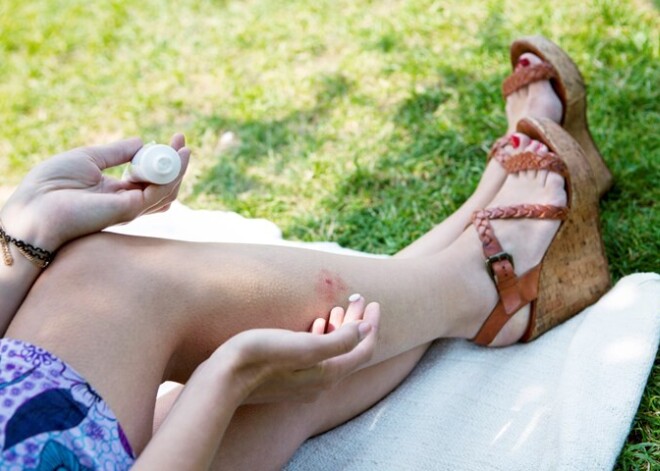 Атаки слепней и не только: эксперт объяснил, почему этим летом насекомые "буквально съедают людей"