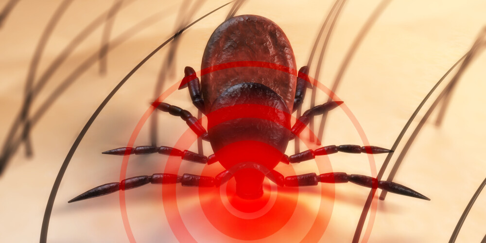 Клещевой боррелиоз (болезнь Лайма) – инфекционное заболевание, характеризующееся широким спектром признаков, наиболее известным из которых является кольцевидная мигрирующая эритема. Основная причина болезни Лайма – попадание в организм бактерий боррелия (Borrelia). Этот вид бактерий переносят преимущественно клещи, в которых они размножаются и выделяются вместе с фекалиями, однако данный вид инфекции может присутствовать и в некоторых видах вшей.Механизм заражения человека боррелиозом происходит через укус клеща. При укусе, или же раздавливании клеща руками, когда его содержимое, часто в совокупности с боррелиями, попадает под кожу, в данном месте развивается аллергическо-воспалительная реакция, характеризующаяся эритемой, постепенно мигрирующей на соседние участки тела, а позже, у человека проявляются признаки интоксикации организма.