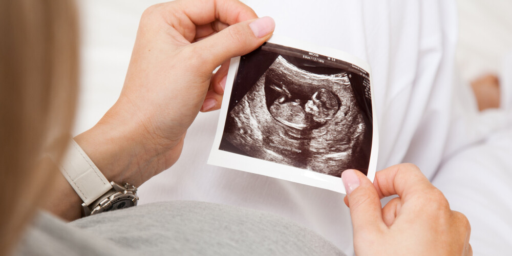 Ребенок родился беременным! Вероятность подобной аномалии - один случай на полмиллиона