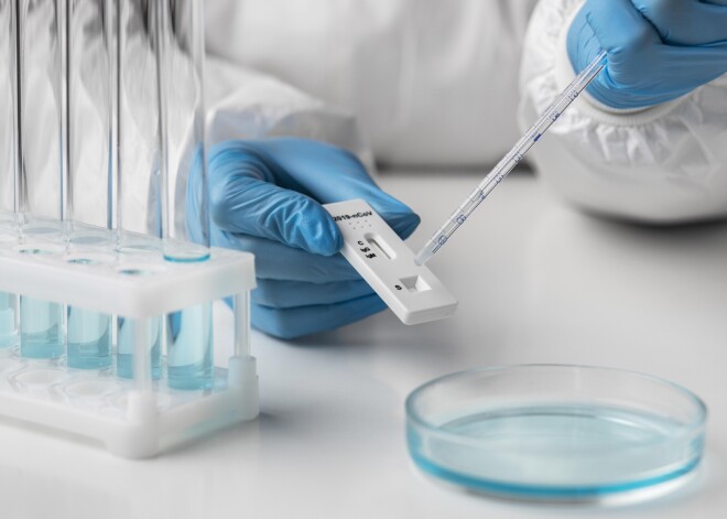 Сколько будут стоить Covid-тесты человеку, не имеющему симптомов?