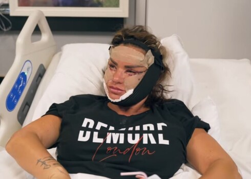 Keitija Praisa pēc daļēja sejas liftinga operācijas.