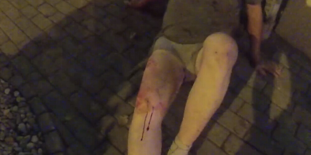 В Саркандаугаве произошло нападение: мужчину обокрали и нанесли ножевые ранения