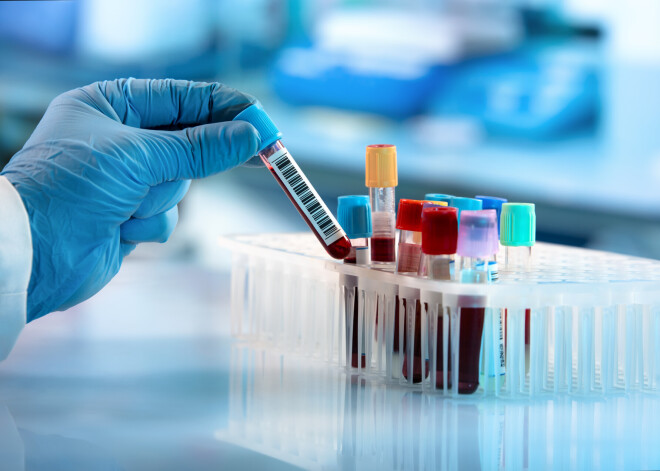 Какие анализы нужно сдавать женщинам: 5 регулярных чек-апов