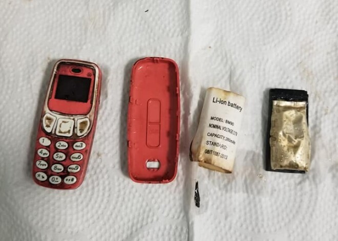 Cietumnieks Kosovā norij "Nokia" telefonu un četras dienas sūdzas par vēdersāpēm. VIDEO