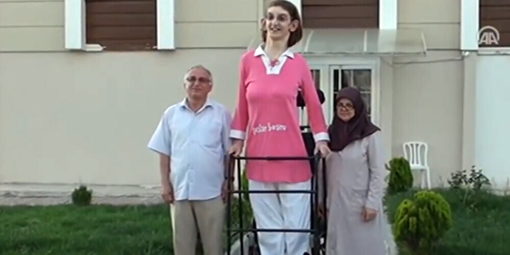 Gelgi lielākoties pārvietojas ar ratiņkrēslu, tomēr spēj to arī darīt, izmantojot staigāšanas rāmi.  