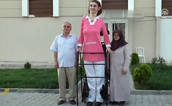 Gelgi lielākoties pārvietojas ar ratiņkrēslu, tomēr spēj to arī darīt, izmantojot staigāšanas rāmi.