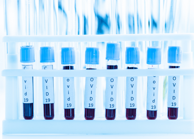 Zinātniski apstiprināts – pašmāju D3 vitamīns spēj palīdzēt saslimušiem ar Covid-19