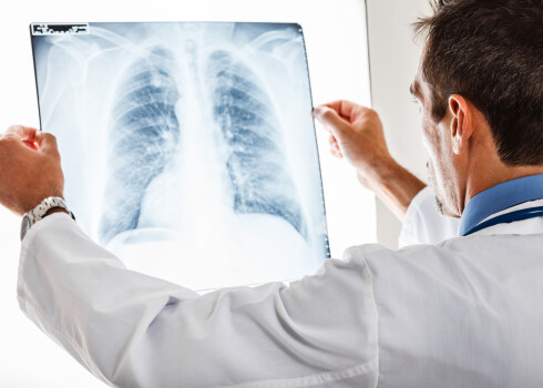 Notiks diskusija “Plaušu vēzis – kā dzīvot tālāk?”