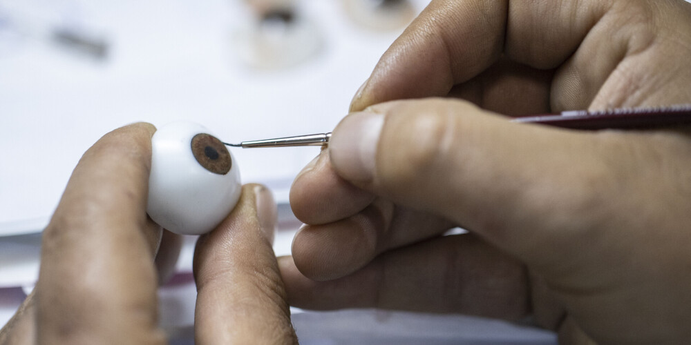 "Izskatās fantastiski!" Pacients Londonā pirmais pasaulē saņems ar 3D printeri radītu acs protēzi