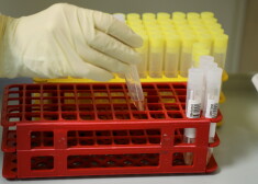 ZZS aicina premjeru skaidrot "nepieredzējuša uzņēmuma" uzvaru Covid-19 antigēnu testu piegādē
