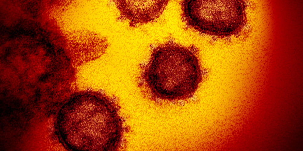 Kas ir “flurona” un cik bīstama ir šī dubultinfekcija?