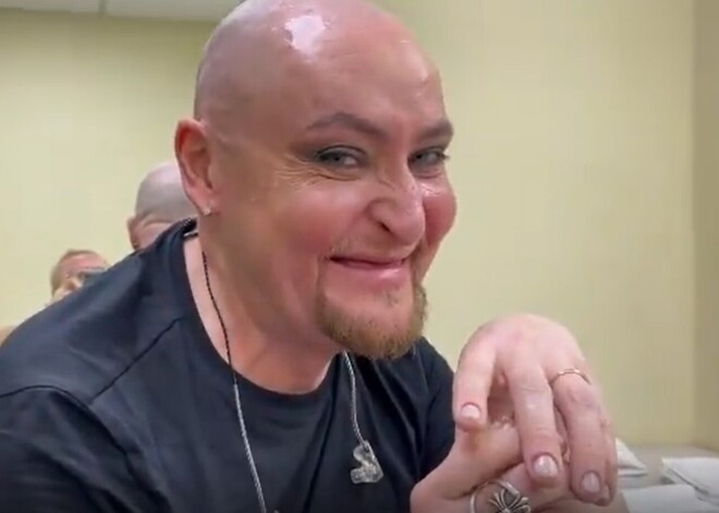 Шура выплюнул челюсть прямо во время выступления